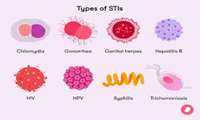 عفونت‌های مقاربتی (STIs) از نگاه دکتر فرحناز فرزانه: راهنمای جامع حفظ سلامتی جنسی